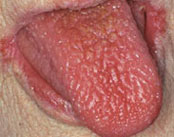 Oral Health - Saliva