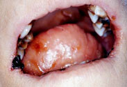 Oral Health - Saliva