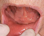 Oral Health - Saliva