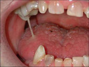 Oral Health - Saliva