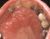 Oral Health - Saliva