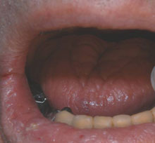 Oral Health - Saliva