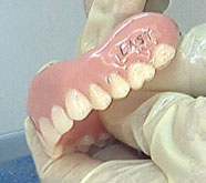 Oral Health Dentures