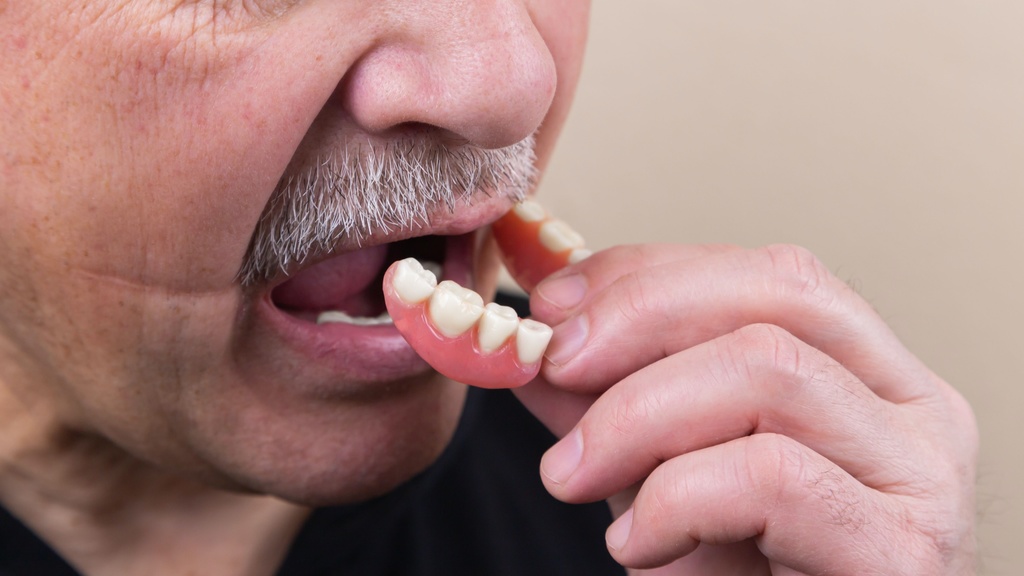 Oral Health - Dentures