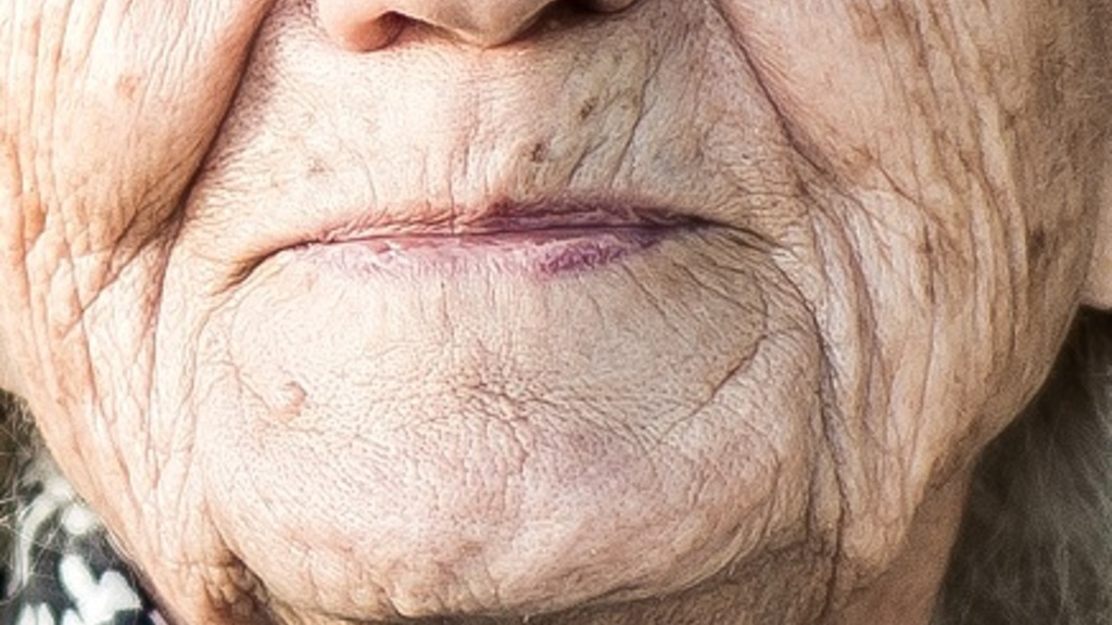 Oral Health - Lips