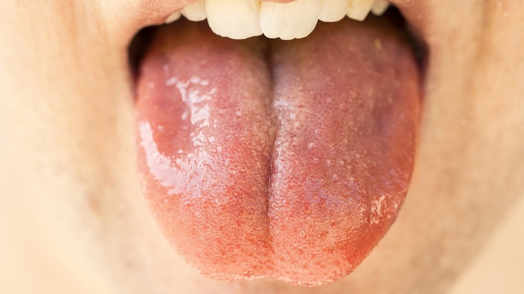 Oral Health - Saliva